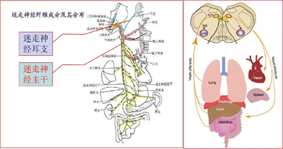 董月青主任成功开展迷走神经刺激联合康复改善脑卒中患者运动功能