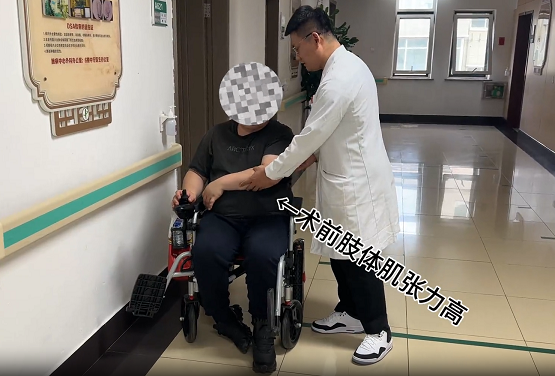 李金劍：腦卒中后偏癱患者的新希望