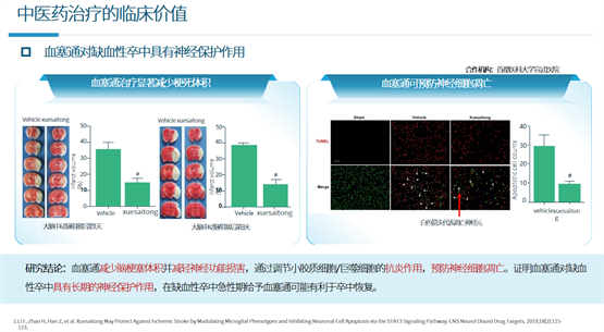聚焦 2025 NCN：多靶共治，中西协同，全程守护脑卒中患者健康！